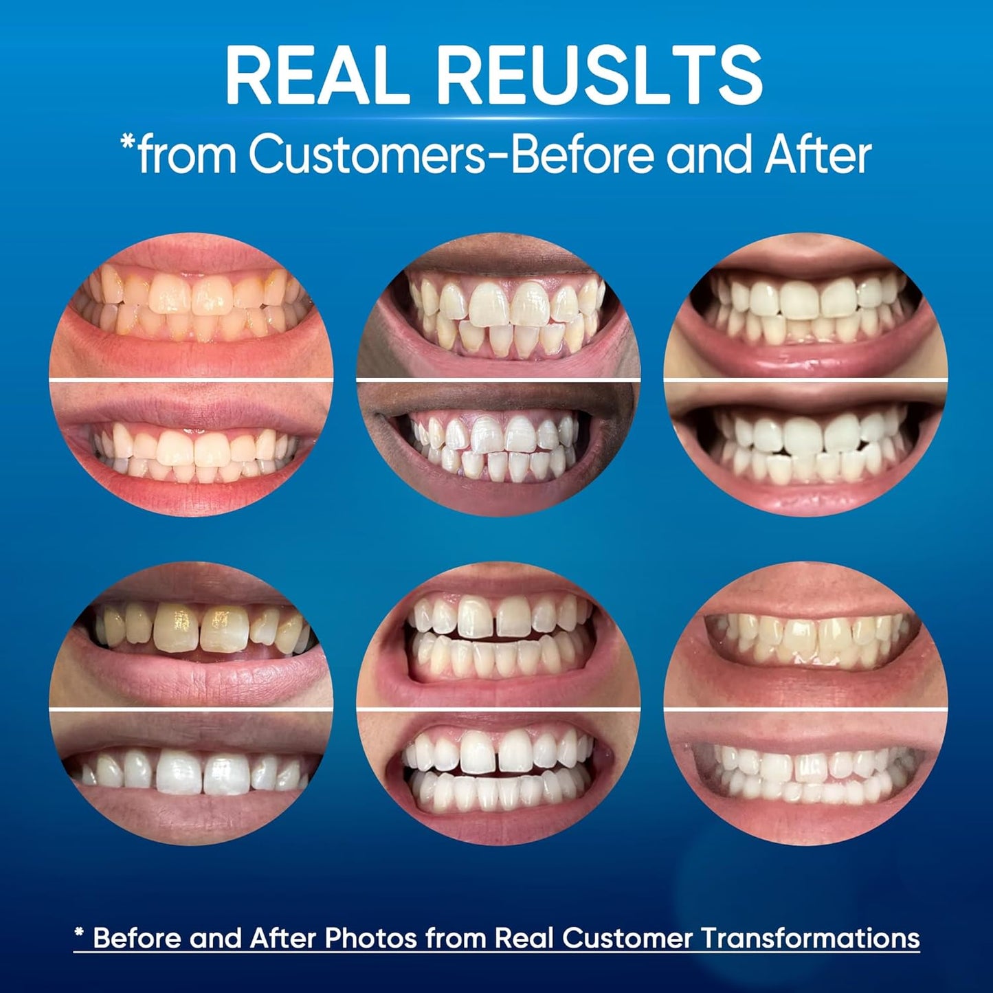 BLANQUEADOR DENTAL